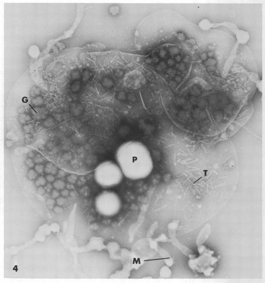 https://cdn.ncbi.nlm.nih.gov/pmc/blobs/2229/249773/e5d3308bc312/jbacter00392-0444-a.jpg