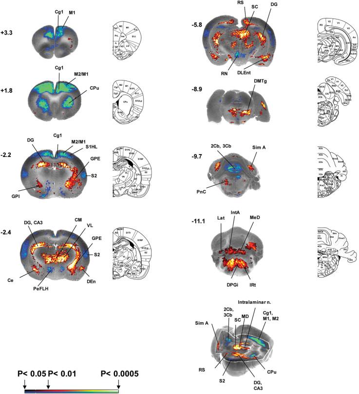 https://cdn.ncbi.nlm.nih.gov/pmc/blobs/222a/12198951/0af8e2e6fceb/j_tnsci-2025-0374-fig003.jpg