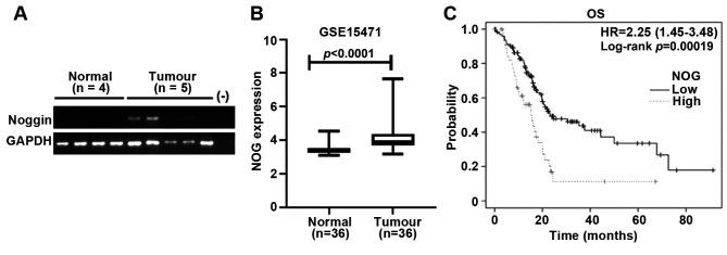 https://cdn.ncbi.nlm.nih.gov/pmc/blobs/222b/12216576/5739226795b2/cgp-22-568-g0001.jpg