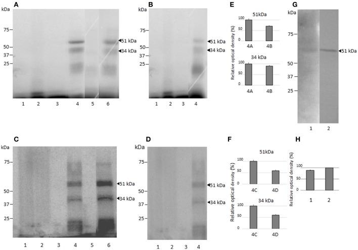 https://cdn.ncbi.nlm.nih.gov/pmc/blobs/222b/5712549/435780970c89/fcimb-07-00492-g0005.jpg