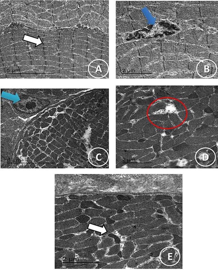 https://cdn.ncbi.nlm.nih.gov/pmc/blobs/2231/10440570/ae5dc8eaa540/gr4.jpg