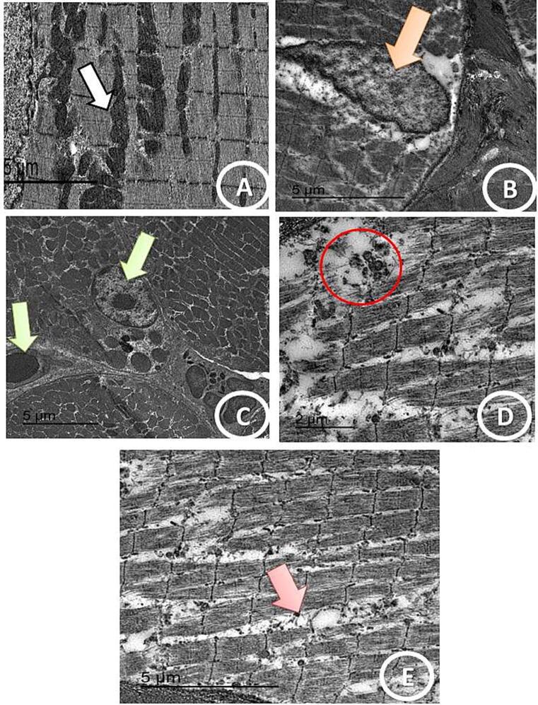 https://cdn.ncbi.nlm.nih.gov/pmc/blobs/2231/10440570/b194fbc46a89/gr5.jpg
