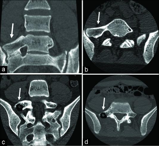https://cdn.ncbi.nlm.nih.gov/pmc/blobs/2233/6744759/ddeaef88e16c/SNI-10-135-g001.jpg