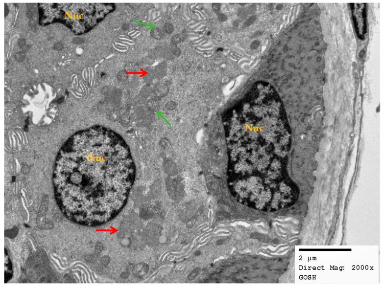 https://cdn.ncbi.nlm.nih.gov/pmc/blobs/2236/9954623/ad08b6161086/brainsci-13-00209-g004.jpg