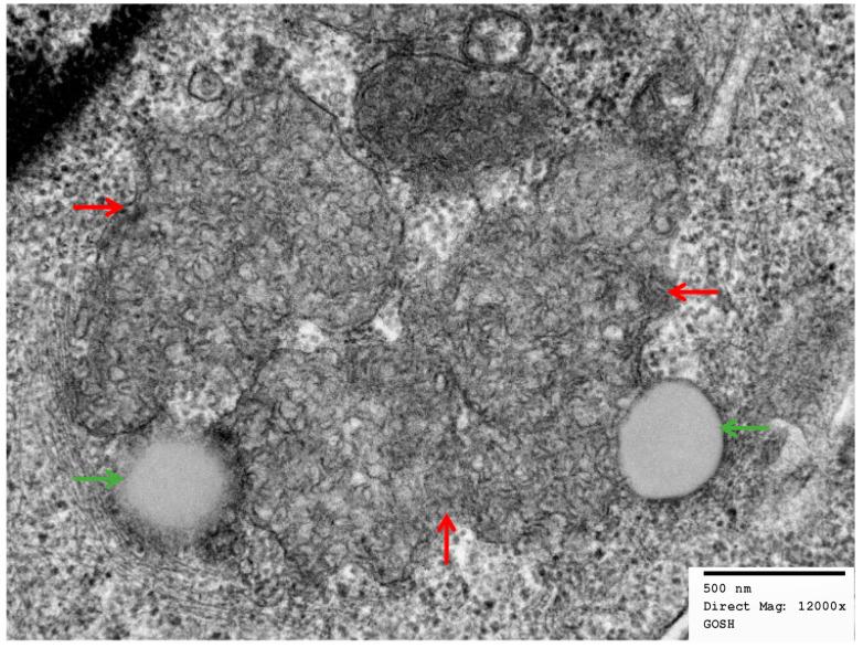 https://cdn.ncbi.nlm.nih.gov/pmc/blobs/2236/9954623/b055013ae4f8/brainsci-13-00209-g005.jpg