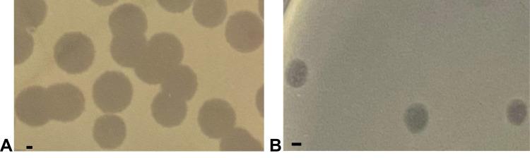 https://cdn.ncbi.nlm.nih.gov/pmc/blobs/2239/9166914/54e00260ed54/IDR-15-2797-g0002.jpg