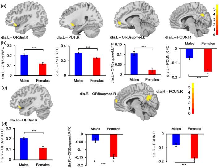 https://cdn.ncbi.nlm.nih.gov/pmc/blobs/2244/9120556/83caa37d97c0/HBM-43-2923-g001.jpg