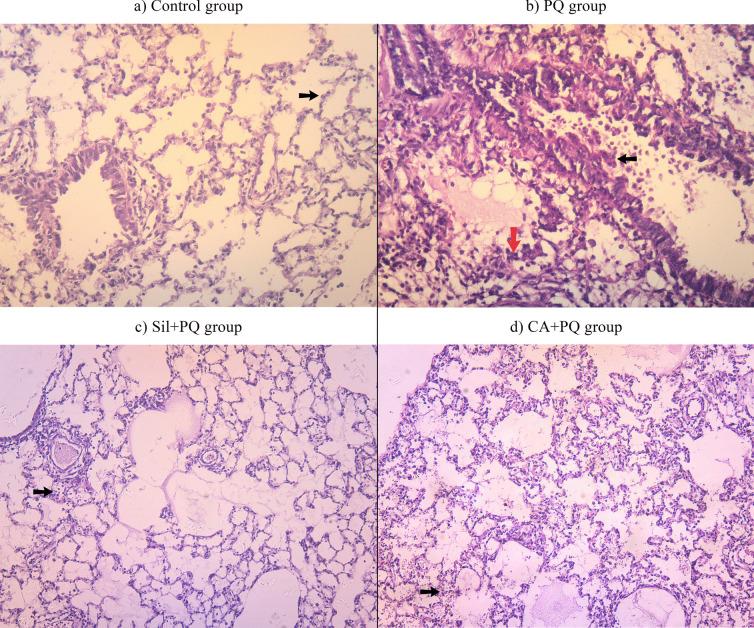 https://cdn.ncbi.nlm.nih.gov/pmc/blobs/224b/11978700/2561942cdeb2/210_2024_3511_Fig1_HTML.jpg