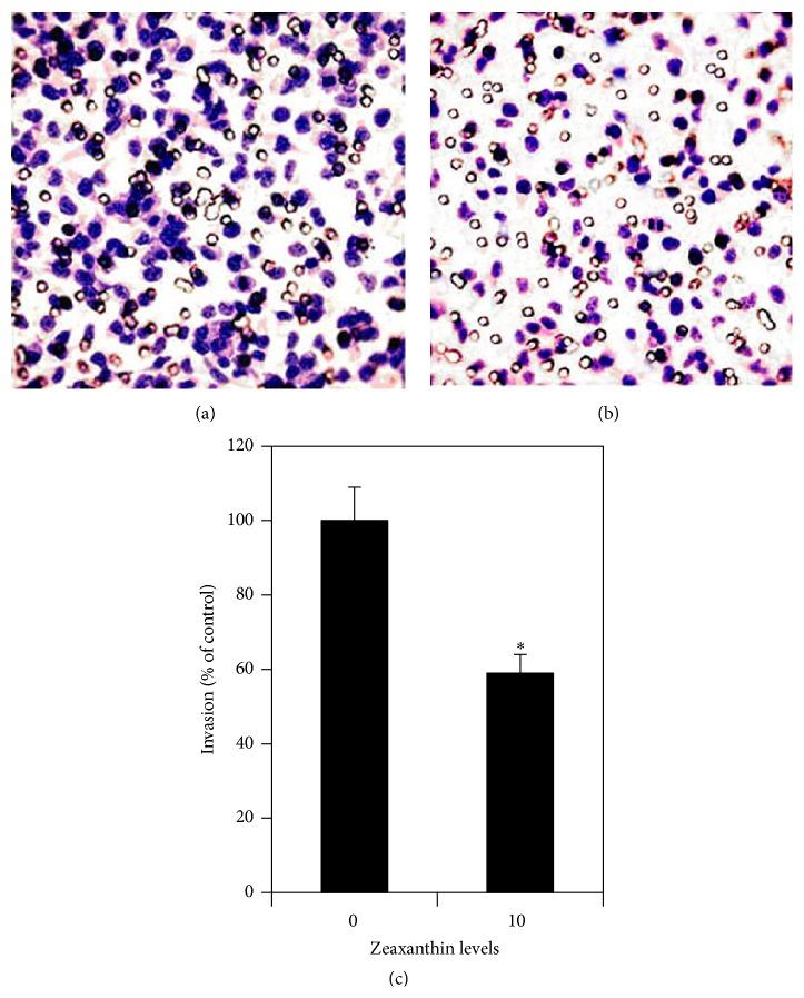 https://cdn.ncbi.nlm.nih.gov/pmc/blobs/224d/4749803/8a01b5bf2b37/JOPH2016-8734309.004.jpg