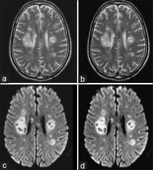 https://cdn.ncbi.nlm.nih.gov/pmc/blobs/2257/10445678/7cbfdb197522/JMSS-13-183-g049.jpg