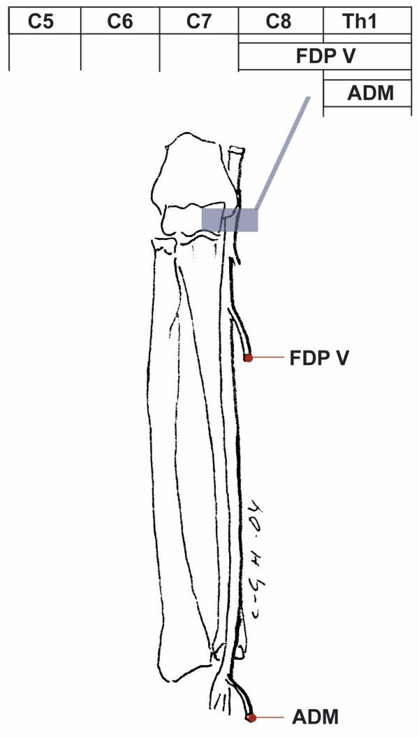 https://cdn.ncbi.nlm.nih.gov/pmc/blobs/225d/1402320/ded67d9ab8d7/1471-2377-6-8-7.jpg