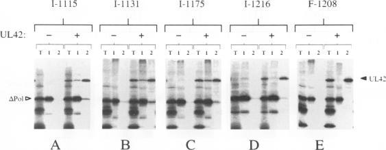 https://cdn.ncbi.nlm.nih.gov/pmc/blobs/2267/237376/0e49ab931508/jvirol00022-0425-a.jpg