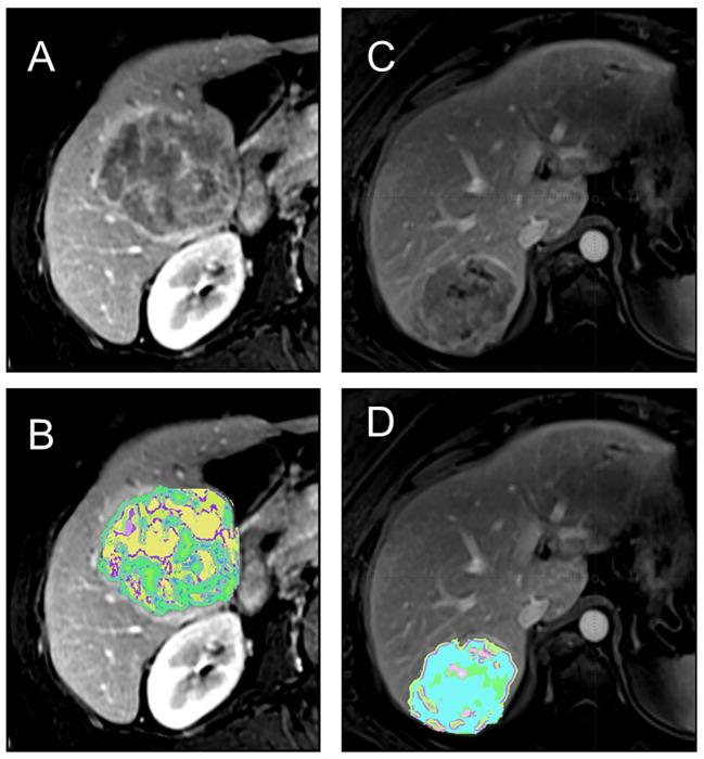 https://cdn.ncbi.nlm.nih.gov/pmc/blobs/226a/11109422/4030ce12489f/fonc-14-1362737-g001.jpg
