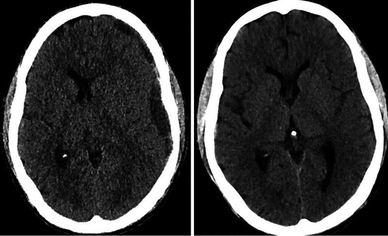 https://cdn.ncbi.nlm.nih.gov/pmc/blobs/226b/10550581/ea5d33143c7d/CASE22273f3.jpg