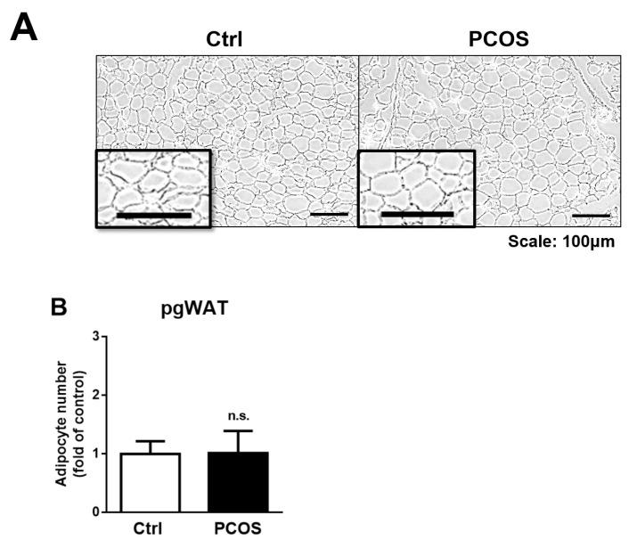 https://cdn.ncbi.nlm.nih.gov/pmc/blobs/227a/8745167/5252e3aa1b43/ijms-23-00134-g005.jpg