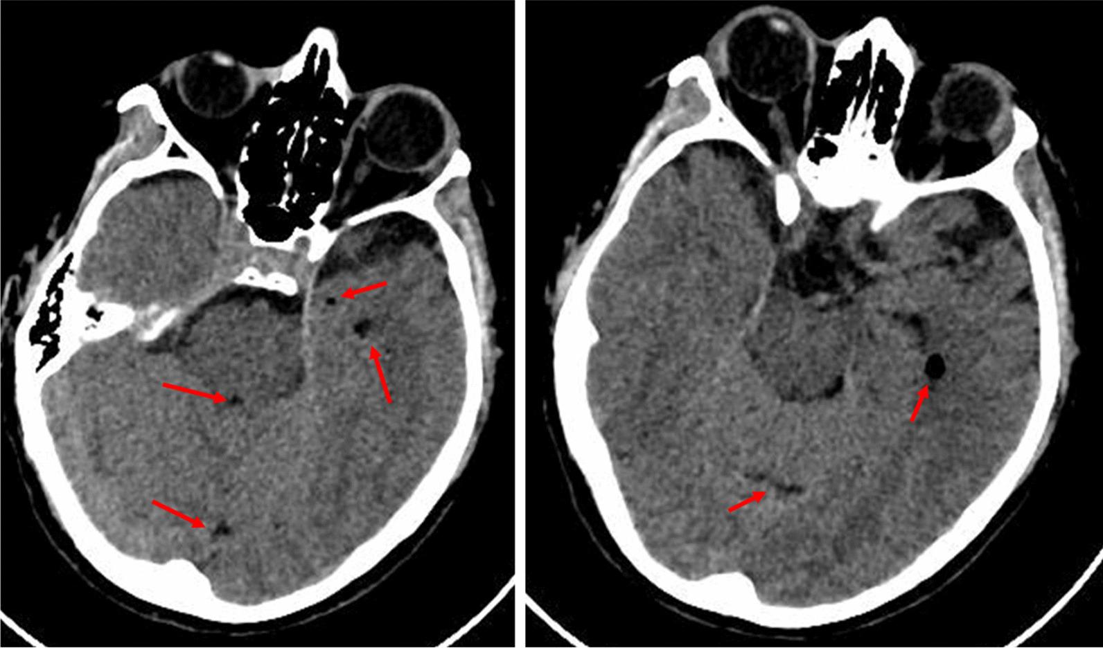 https://cdn.ncbi.nlm.nih.gov/pmc/blobs/227c/9936684/52c6e1cee56d/13256_2023_3754_Fig1_HTML.jpg