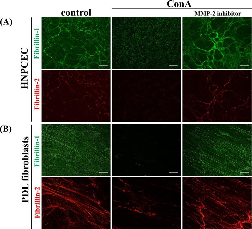 https://cdn.ncbi.nlm.nih.gov/pmc/blobs/227d/3813822/6df0d9813ccf/AHC13024f04.jpg