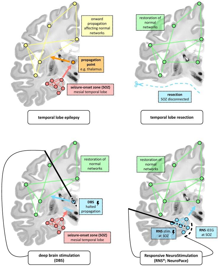 https://cdn.ncbi.nlm.nih.gov/pmc/blobs/2282/9586548/feb0e37bcf80/awac234f1.jpg