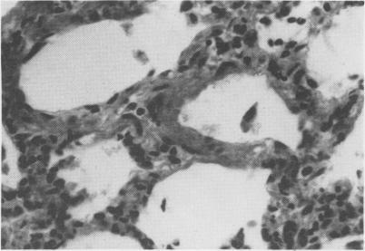 https://cdn.ncbi.nlm.nih.gov/pmc/blobs/2283/1696680/8a71dbd7db71/canvetj00419-0047-c.jpg