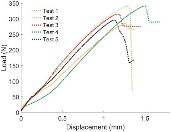 https://cdn.ncbi.nlm.nih.gov/pmc/blobs/2286/6790990/eed1dc282a24/10.1177_0954411919874523-fig6.jpg