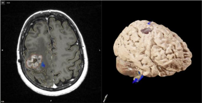 https://cdn.ncbi.nlm.nih.gov/pmc/blobs/228a/12198064/a28c2a5a8f03/11060_2025_5047_Fig2_HTML.jpg