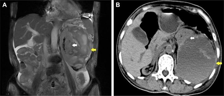 https://cdn.ncbi.nlm.nih.gov/pmc/blobs/228e/5848664/87dc78f2191c/tcrm-14-489Fig1.jpg