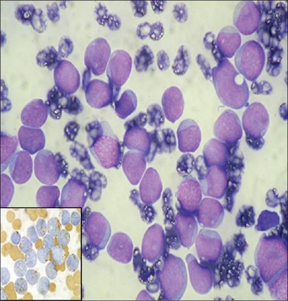 https://cdn.ncbi.nlm.nih.gov/pmc/blobs/2291/5952454/3338bac7e17b/IJN-28-153-g002.jpg