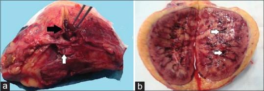 https://cdn.ncbi.nlm.nih.gov/pmc/blobs/2291/5952454/596b6e209670/IJN-28-153-g003.jpg