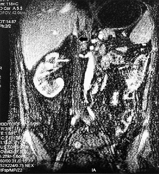 https://cdn.ncbi.nlm.nih.gov/pmc/blobs/2291/5952454/dcc748d47693/IJN-28-153-g004.jpg