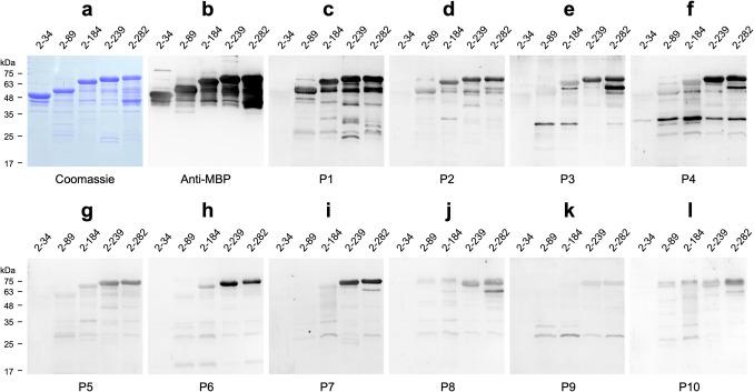 https://cdn.ncbi.nlm.nih.gov/pmc/blobs/2295/11965195/555d7c2cff2d/253_2025_13466_Fig7_HTML.jpg