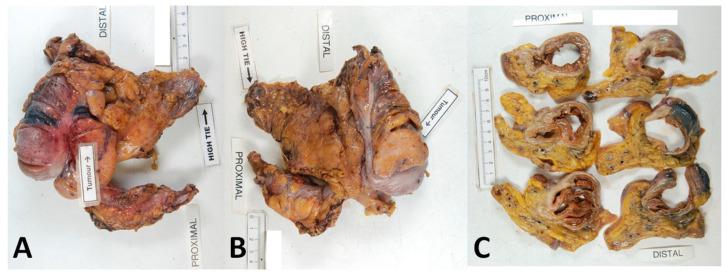 https://cdn.ncbi.nlm.nih.gov/pmc/blobs/2296/10452811/04b6859a2a1b/cancers-15-04116-g003.jpg