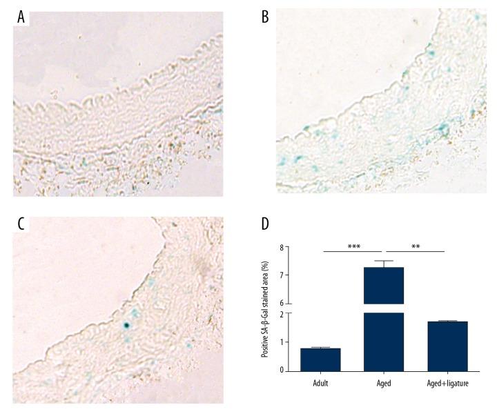 https://cdn.ncbi.nlm.nih.gov/pmc/blobs/2296/6637813/ac315da5ea88/medscimonit-25-5127-g002.jpg