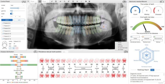 https://cdn.ncbi.nlm.nih.gov/pmc/blobs/229c/12104361/9b7a36749df8/41598_2025_1733_Fig2_HTML.jpg