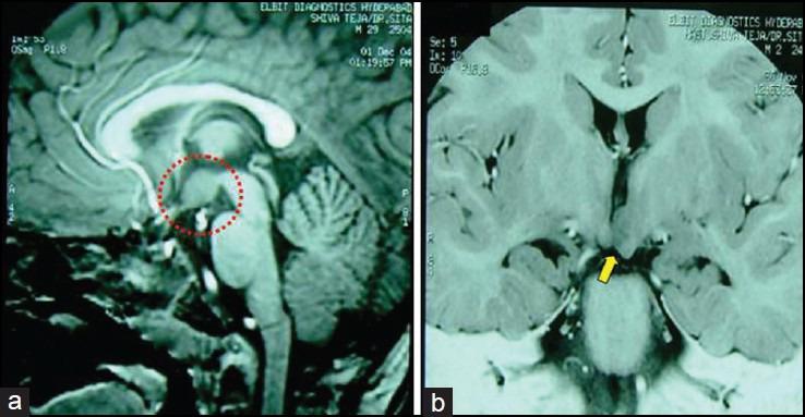 https://cdn.ncbi.nlm.nih.gov/pmc/blobs/229c/3992768/97567604d808/AIAN-17-43-g003.jpg