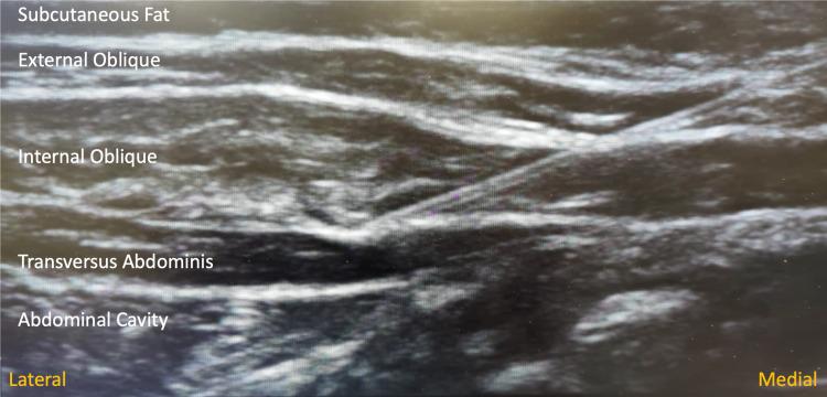 https://cdn.ncbi.nlm.nih.gov/pmc/blobs/22a2/10946280/736db583c330/JPR-17-981-g0003.jpg