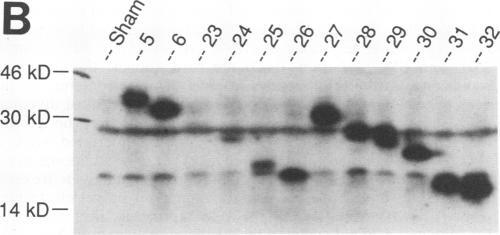 https://cdn.ncbi.nlm.nih.gov/pmc/blobs/22a3/250265/6c4c326869b9/jvirol00054-0361-b.jpg