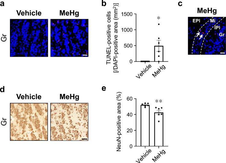 https://cdn.ncbi.nlm.nih.gov/pmc/blobs/22a9/10944439/4db01b67b694/204_2024_3682_Fig2_HTML.jpg