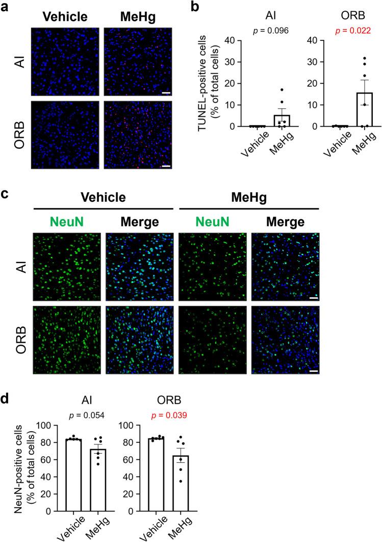 https://cdn.ncbi.nlm.nih.gov/pmc/blobs/22a9/10944439/9a042babf5b9/204_2024_3682_Fig4_HTML.jpg