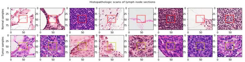 https://cdn.ncbi.nlm.nih.gov/pmc/blobs/22ad/7915222/3e5da25bd187/cancers-13-00661-g003.jpg