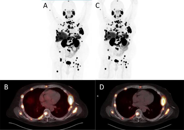 https://cdn.ncbi.nlm.nih.gov/pmc/blobs/22b3/9803810/cf8eee039107/gr3.jpg