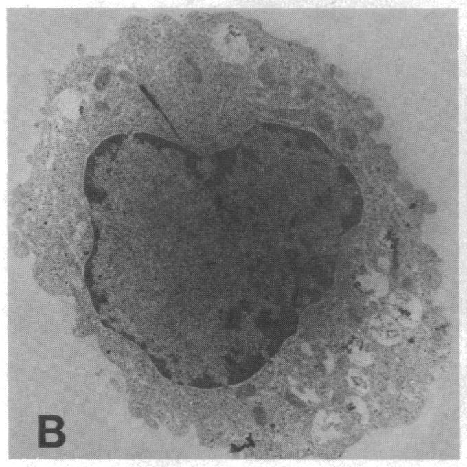 https://cdn.ncbi.nlm.nih.gov/pmc/blobs/22b4/425391/24203672ddda/jcinvest00138-0145-d.jpg