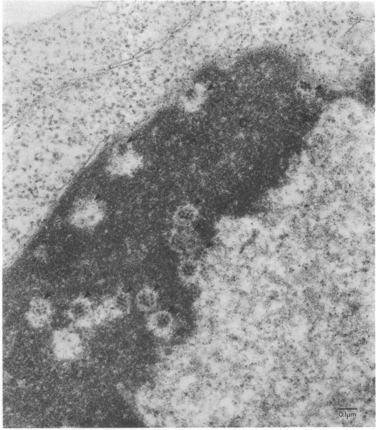 https://cdn.ncbi.nlm.nih.gov/pmc/blobs/22b4/425391/6261388cc4b2/jcinvest00138-0146-a.jpg