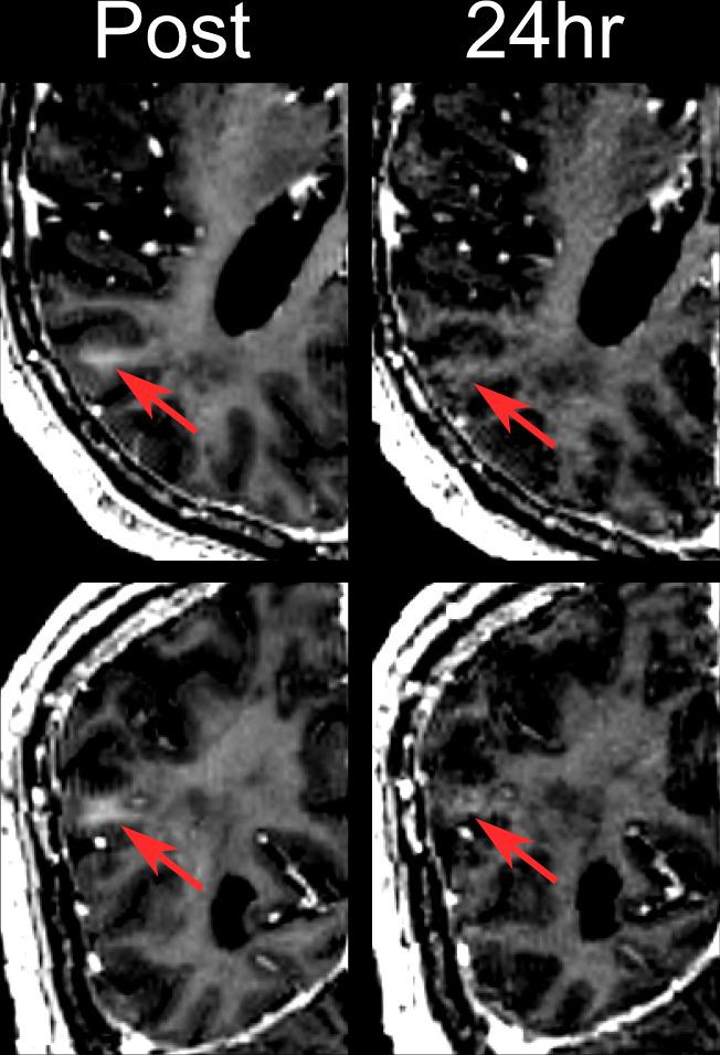 https://cdn.ncbi.nlm.nih.gov/pmc/blobs/22b7/7859400/8926669ed525/41467_2021_21022_Fig2_HTML.jpg