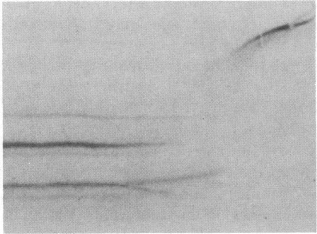 https://cdn.ncbi.nlm.nih.gov/pmc/blobs/22b9/323040/1cb42046a688/pnas00309-0029-c.jpg