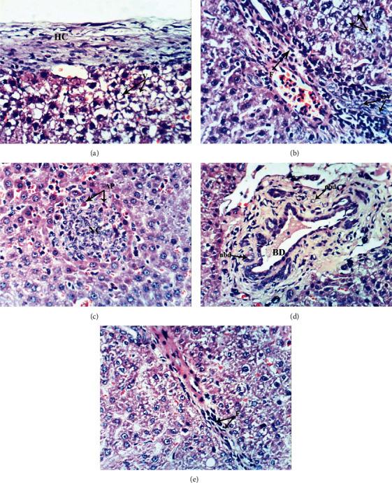 https://cdn.ncbi.nlm.nih.gov/pmc/blobs/22d5/8844103/17b9d5d9f584/OMCL2022-6702773.005.jpg