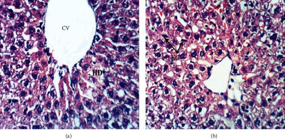 https://cdn.ncbi.nlm.nih.gov/pmc/blobs/22d5/8844103/cc76d0d18567/OMCL2022-6702773.006.jpg