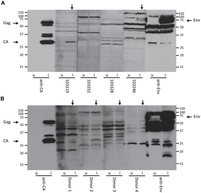 https://cdn.ncbi.nlm.nih.gov/pmc/blobs/22d9/3278456/8654b9335336/pone.0031398.g004.jpg