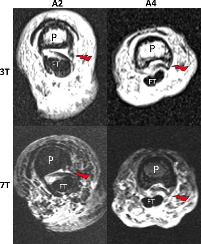 https://cdn.ncbi.nlm.nih.gov/pmc/blobs/22dc/11410841/ca4ff0d5e764/256_2024_4671_Fig3_HTML.jpg