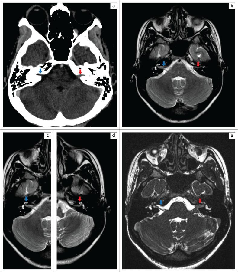 https://cdn.ncbi.nlm.nih.gov/pmc/blobs/22eb/8991266/7067c03729d9/SAJR-26-2351-g002.jpg