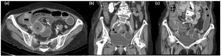 https://cdn.ncbi.nlm.nih.gov/pmc/blobs/22ec/9689930/5e19e28ba17e/diagnostics-12-02832-g002.jpg